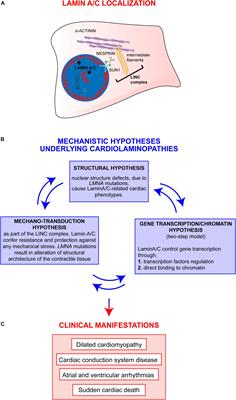 The Broad Spectrum of LMNA Cardiac Diseases: From Molecular Mechanisms to Clinical Phenotype